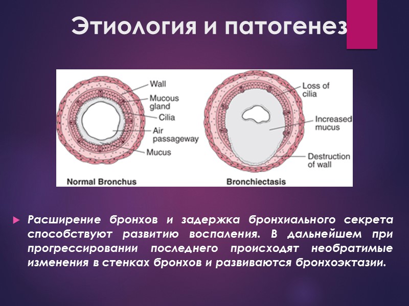 Этиология и патогенез Расширение бронхов и задержка бронхиального секрета способствуют развитию воспаления. В дальнейшем